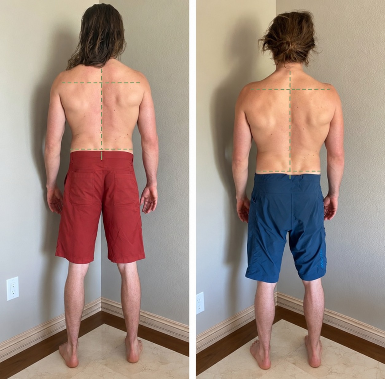 Thoracic Opening & Shoulder Girdle — Before and After